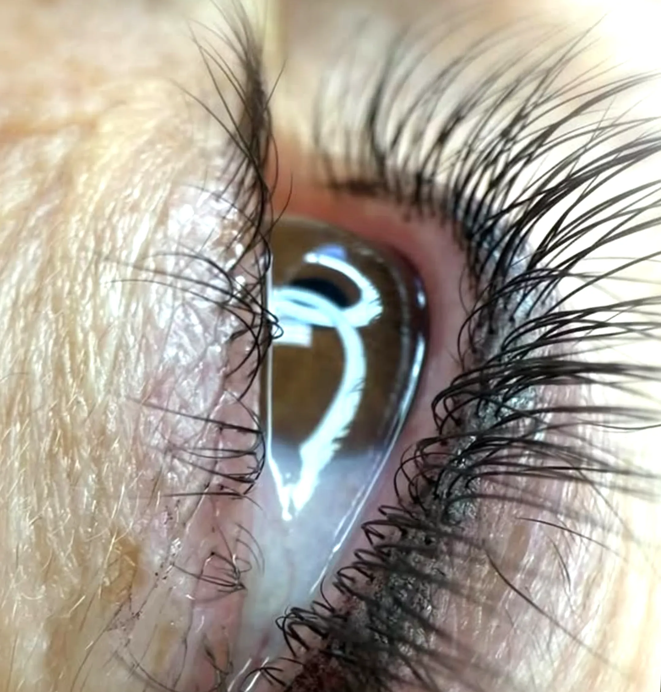 healing after eyeliner tattoo